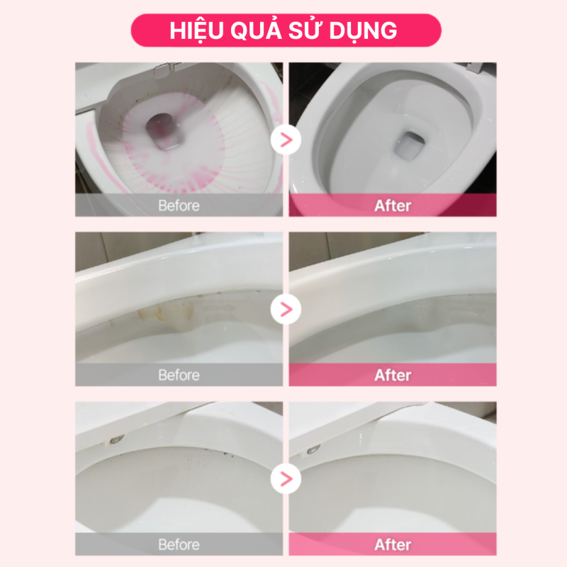 Chai Dung Dịch Tẩy Bồn Cầu Frosch 750ml Hương Chanh